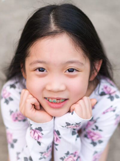 early orthodontic treatment